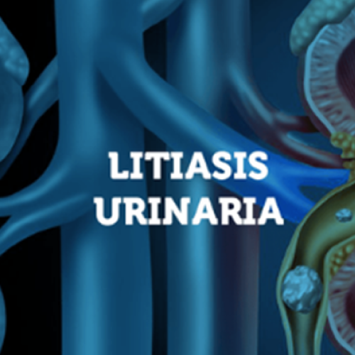 Urolitiasis