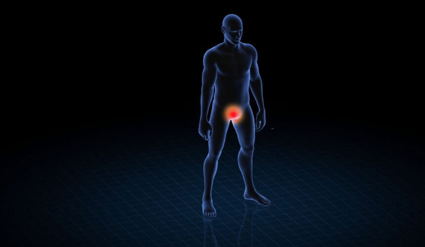 Urólogo en Monterrey: ¿es muy peligroso el VPH en hombres? Urólogo en Monterrey: ¿es muy peligroso el VPH en hombres?